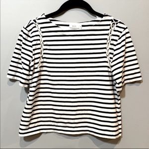 A.L.C. White & Black Horizontal Stripe Top w/ Open Cut Out Shoulders